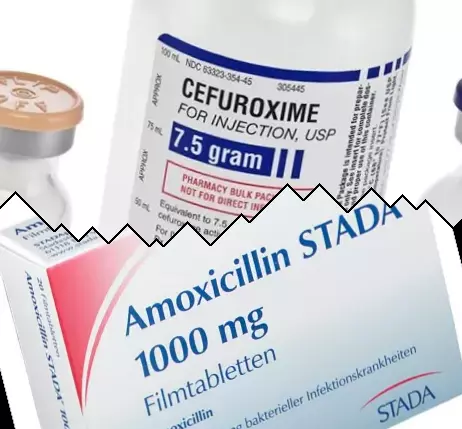 Cefuroxim vs Amoxicillin